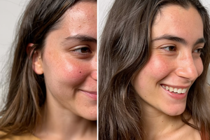 كيف كانت و كيف ولّات ف 15 يوم فقط… و شوفو الفرق