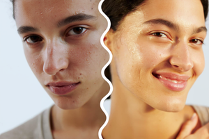 النتيجة لي حتى حنا ما توقعناش 🤍